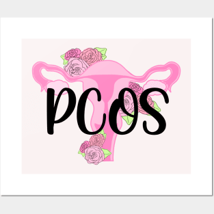 PCOS Posters and Art